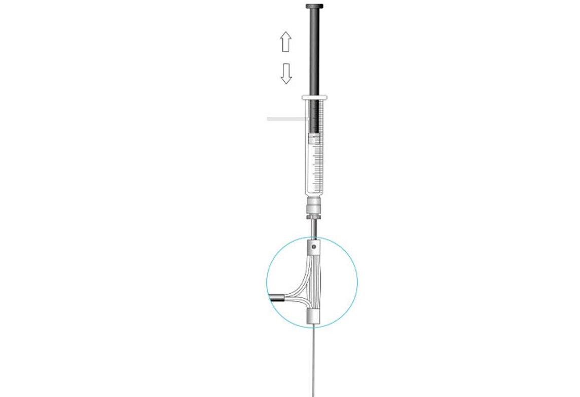 PAL ITEX DHS Syringe with ITEX Trap