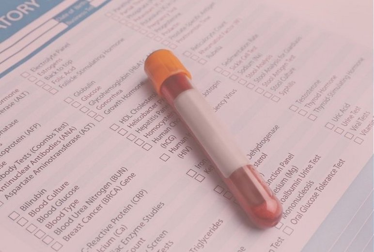 A vial of blood serum lying on a laboratory test request form. V-ITEX is used to analyze the serum volatilome to find biomarkers related to diet and health.