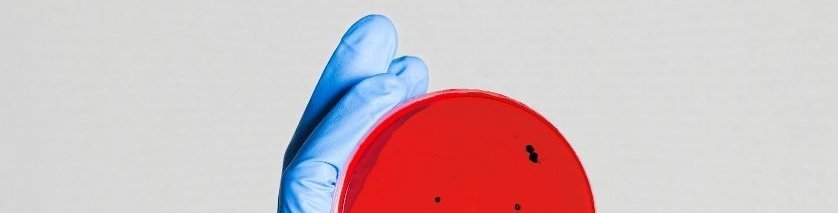 A lab scientist in gloves holding up a blood agar plate with bacteria growth on it.